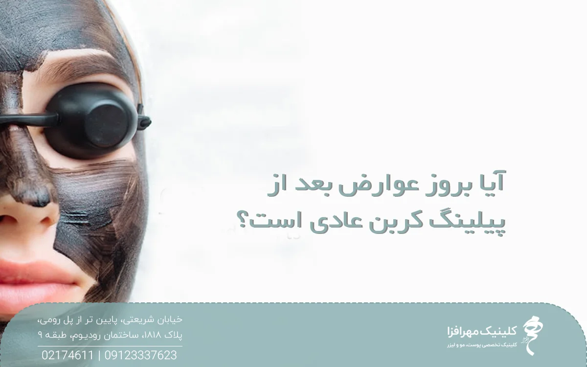 دختری که عینک محافظ به چشم زده است و روی عکس نوشته شده آیا بروز عوارض بعد از پیلینگ کربن عادی است
