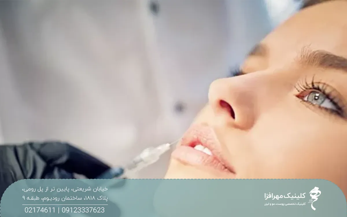 دختری که پزشک سرنگ حاوی فیلر را کنار لب بالای او نگه داشته است