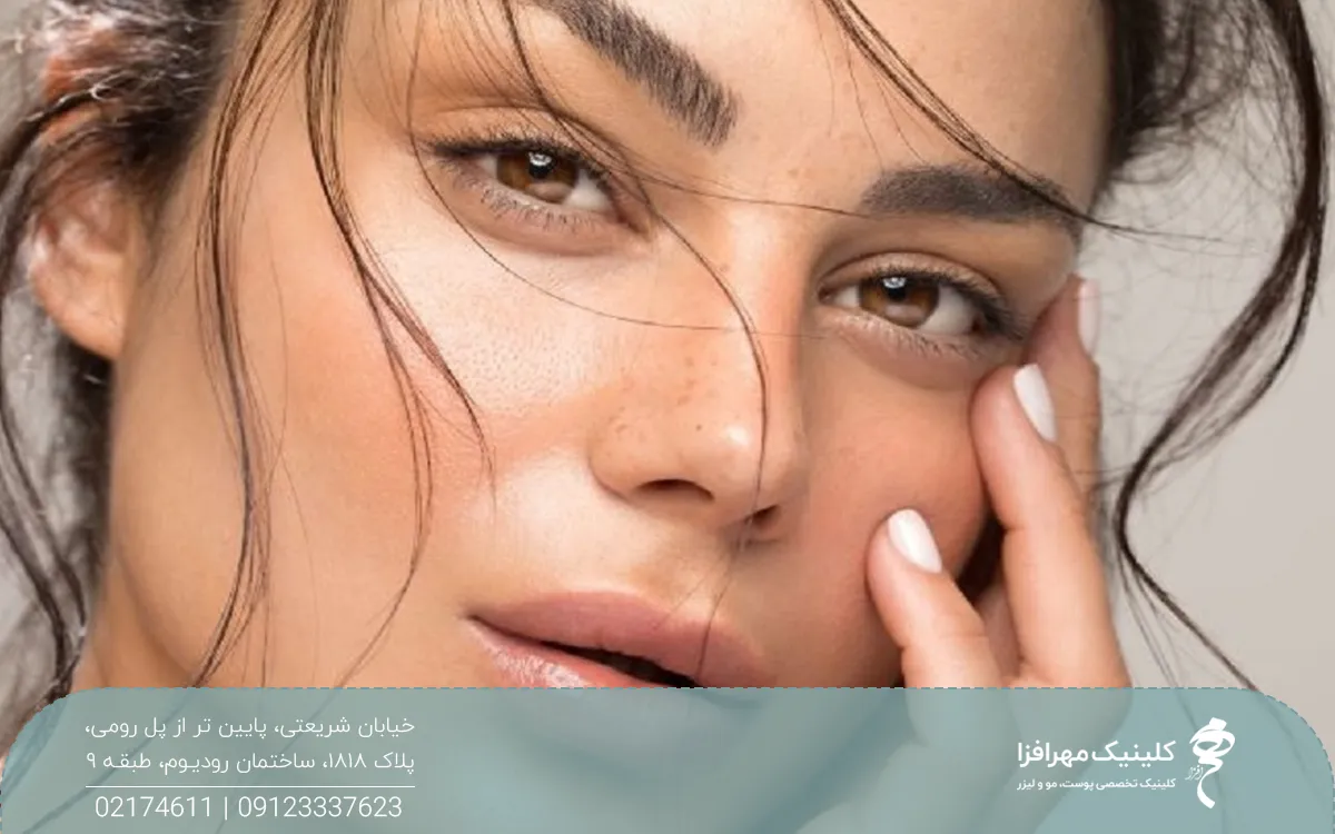 خانمی که به رو به رو نگاه میکند و دستش روی صورتش است و موهایش روی صورتش ریخته شده است