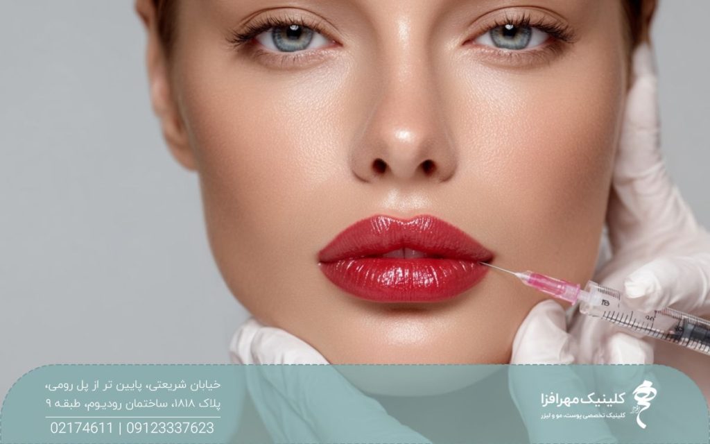 دختر با لب های پهن که پزشکی یک سرنگ ژل را گوشه لب او گرفته است