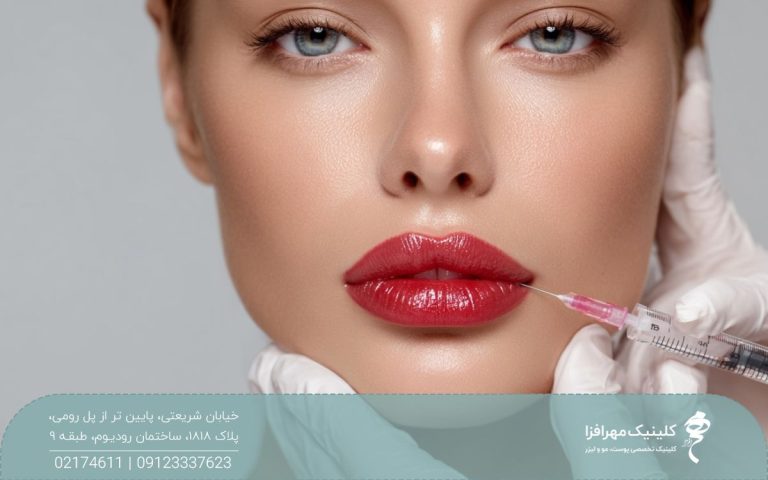 دختر با لب های پهن که پزشکی یک سرنگ ژل را گوشه لب او گرفته است