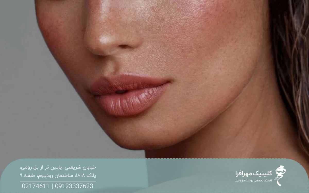 عکس از لب های دختر