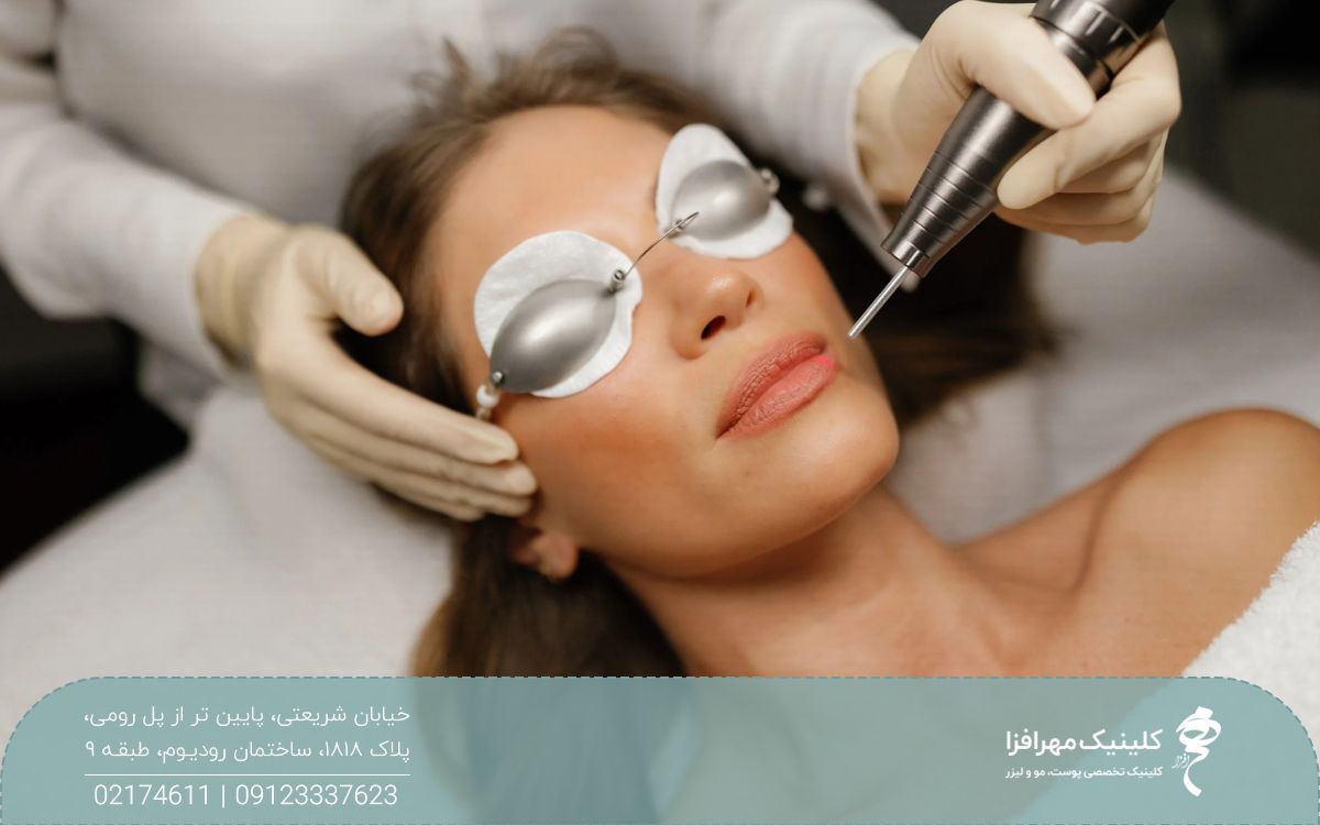 دختری که عینک محافظ به چشم زده است و اپراتور لیزر را روی لب پایین او گرفته است