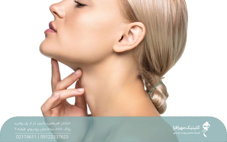 دختری که چانه خود را بالا نگه داشته و دست خود را زیر گردنش گرفته است