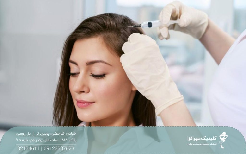 زن با موهای بلند که پزشک با سرنگ روی موهای او پی آر پی انجام می دهد