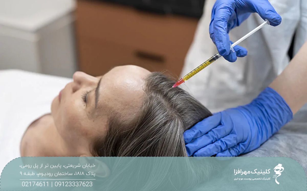 دختری که روی تخت کلینیک دراز کشیده و پزشکی موهای او را پی آر پی می کند