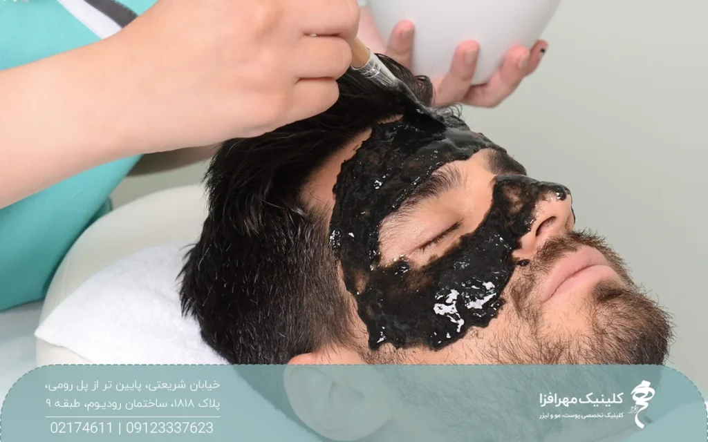 مرد جوانی که خوابیده و دست اپراتوری که در حال گذاشتن ماسک ذغال روی صورت او است