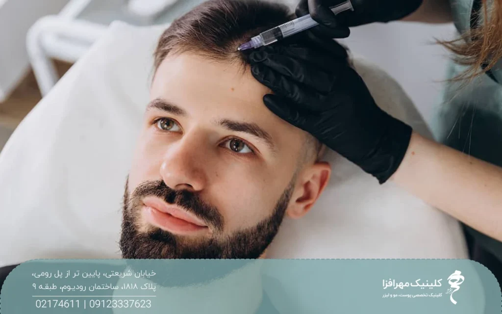 مردی که روی تخت کلینیک دراز کشیده و پزشک ناحیه خط رویش موی او را مزوتراپی می کند