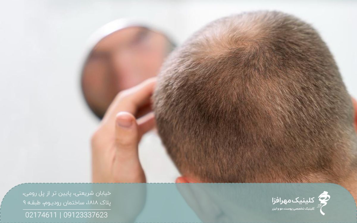 عکس از پشت سر مردی که موهای خود را در آینه چک می کند