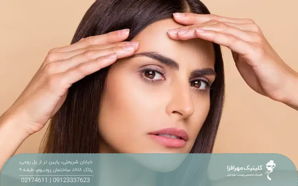 خانمی که هر دو دستش روی پیشانی اش است و به رو به رو نگاه میکند