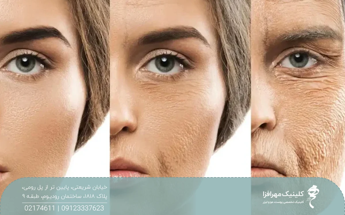 عکس کلاژ از صورت زنی که از راست به چپ تصویر او جوان تر شده است