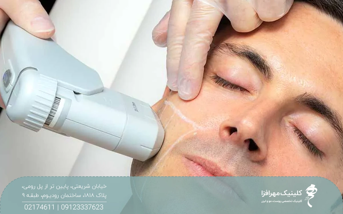 مردی که چشم خود را بسته و فردی هندپیس دستگاه جوانساز را روی طرف راست صورت او گرفته است