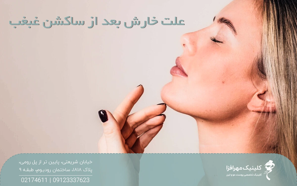عکس دختری که چانه خود را بالا گرفته و دستش زیر چانه اش است و روی عکس نوشته شده علت خارش بعد از ساکشن غبغب