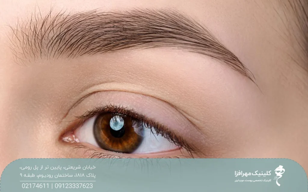 عکس از ابروی دختری که ابروی پرپشتی دارد