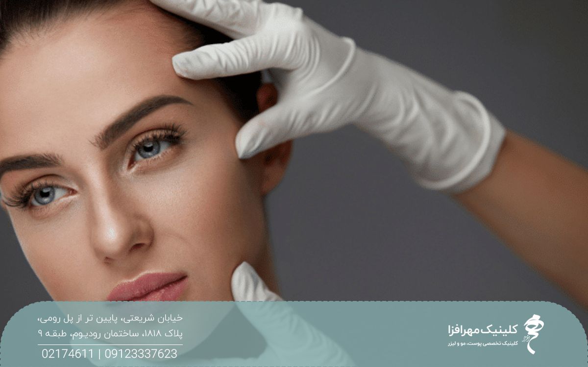 دختری که صورت خود را متمایل به چپ گرفته است و پزشک مشغول معاینه پوست صورت او است