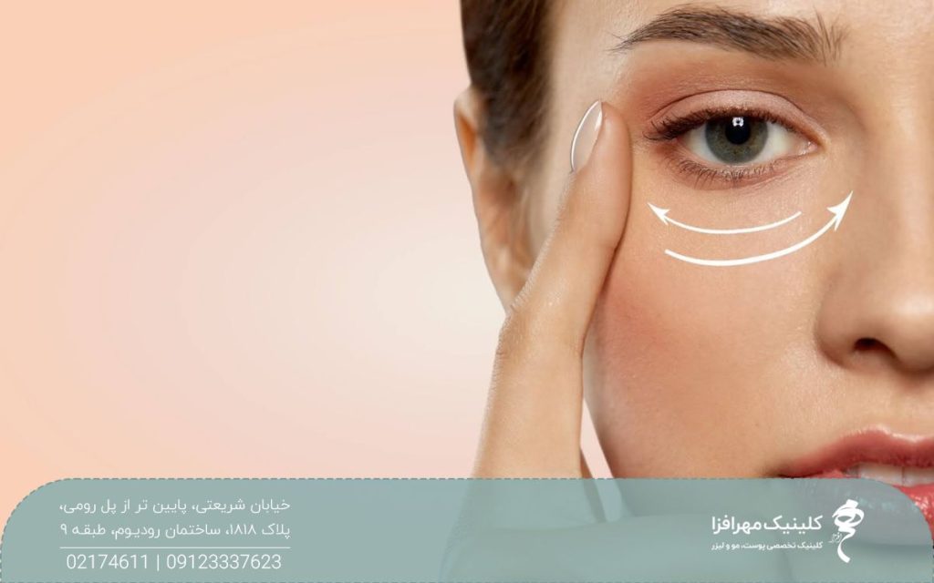 عکس صورت دختری که زیر چشم او دو خط چین سفید کشیده شده است