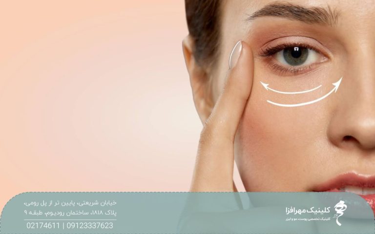 عکس صورت دختری که زیر چشم او دو خط چین سفید کشیده شده است