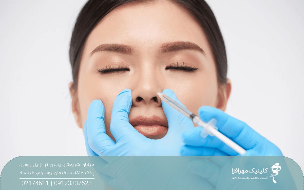 دختری که چشم خود را بسته و پزشک به نوک بینی او فیلر تزریق می کند
