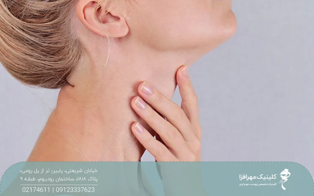 خانمی که دستش روی گردنش است