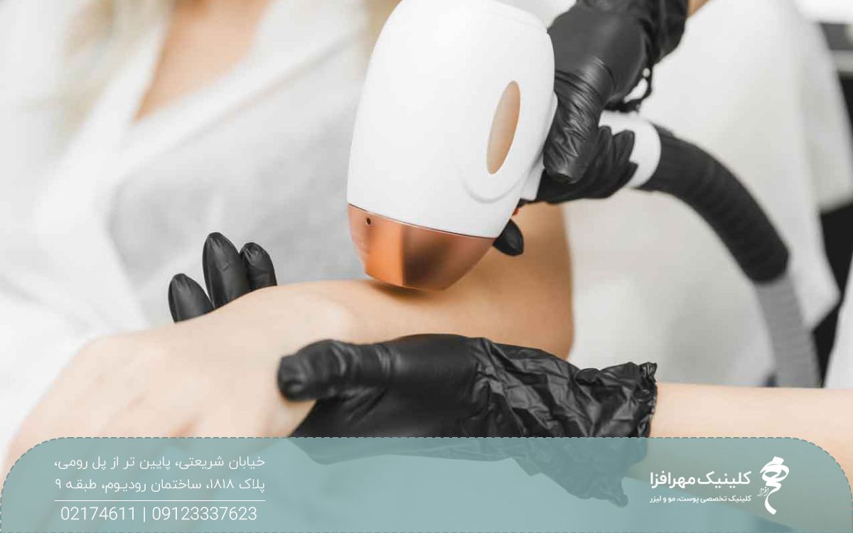 پزشکی که هندپیس لیزر را روی ساق دست فرد حرکت می دهد