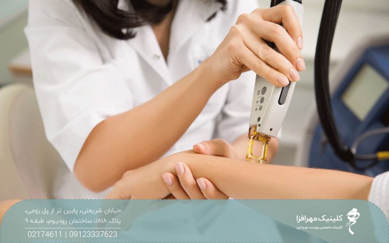 اپراتور لیزر که هندپیس دستگاه را روی دست دختر قرار داده و مشغول لیزر کردن دست او است