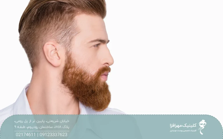نیمرخ مردی که ریش و سیبیل پر و بلندی دارد