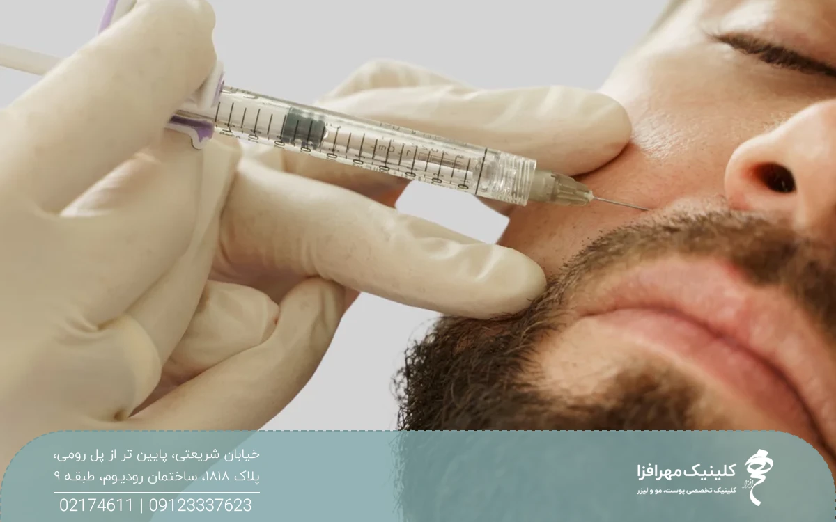 دستان دکتری که درحال تزریق چربی خط خنده بر روی صورت مرد است