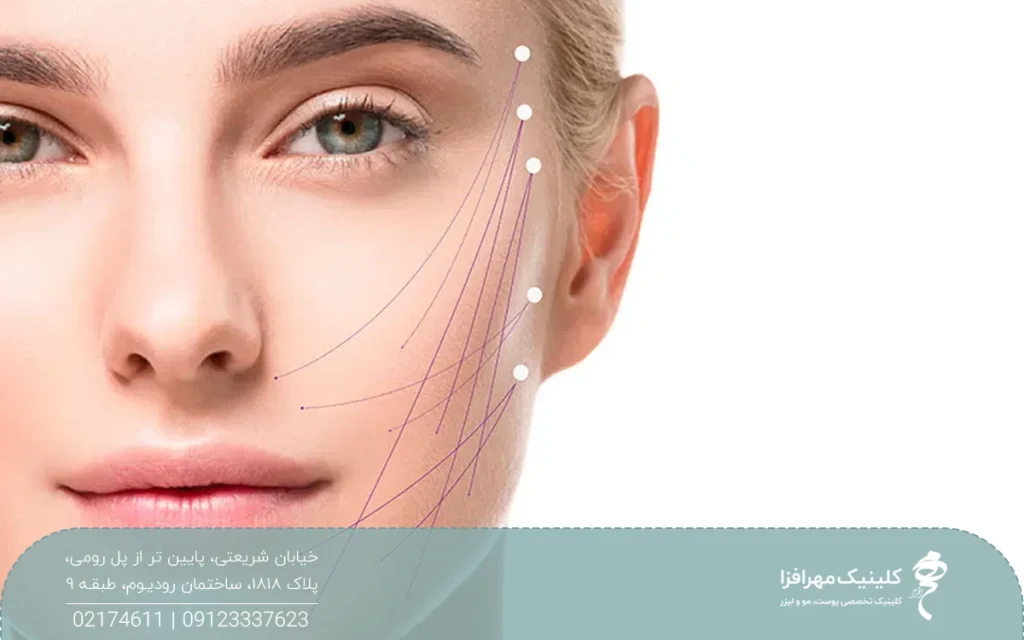 عکس از نیمی از صورت دختری که روی صورت او چند خط رسم شده است