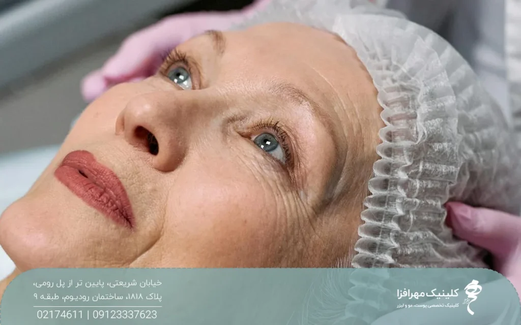 خانم خوشحالی که کلاه مخصوص به سر دارد و به بالا نگاه میکند