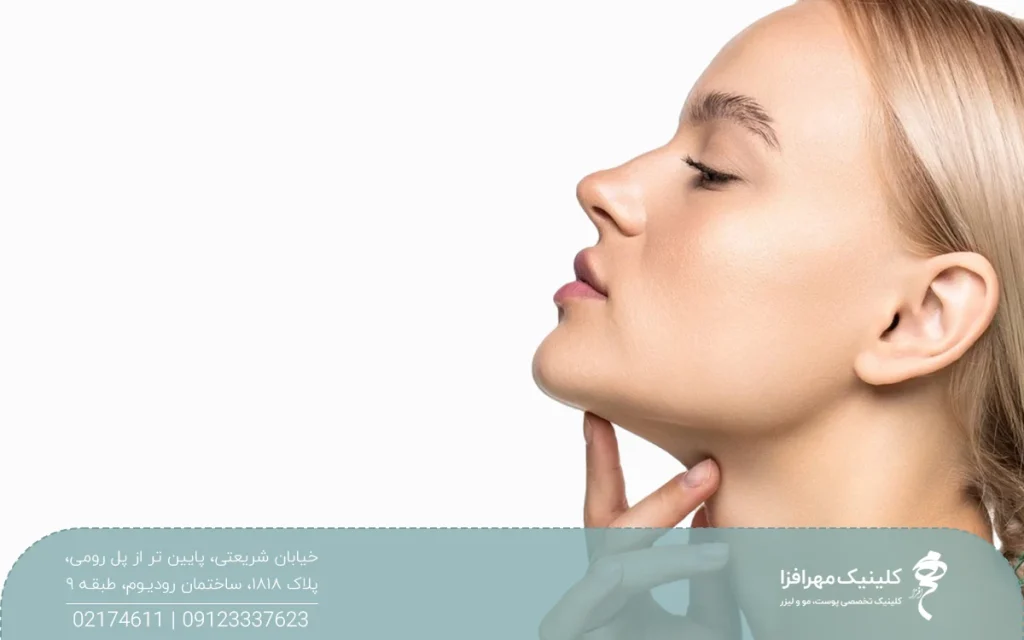 دختری که چانه خود را بالا گرفته است و دست خود را زیر چانه اش گرفته است