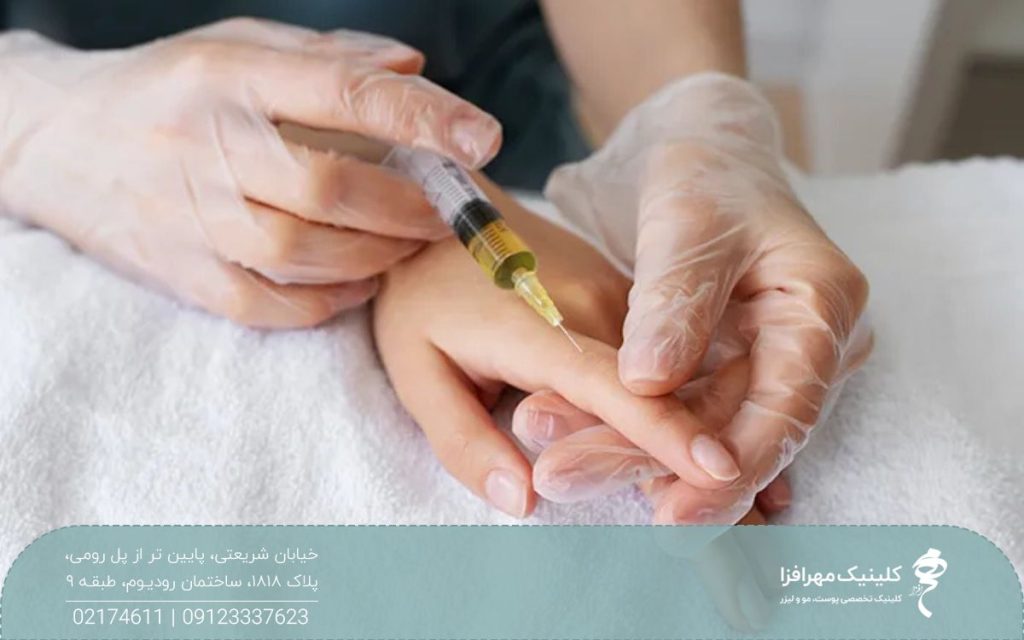 دستان پزشکی که به دست مراجعه کننده چربی تزریق می کند