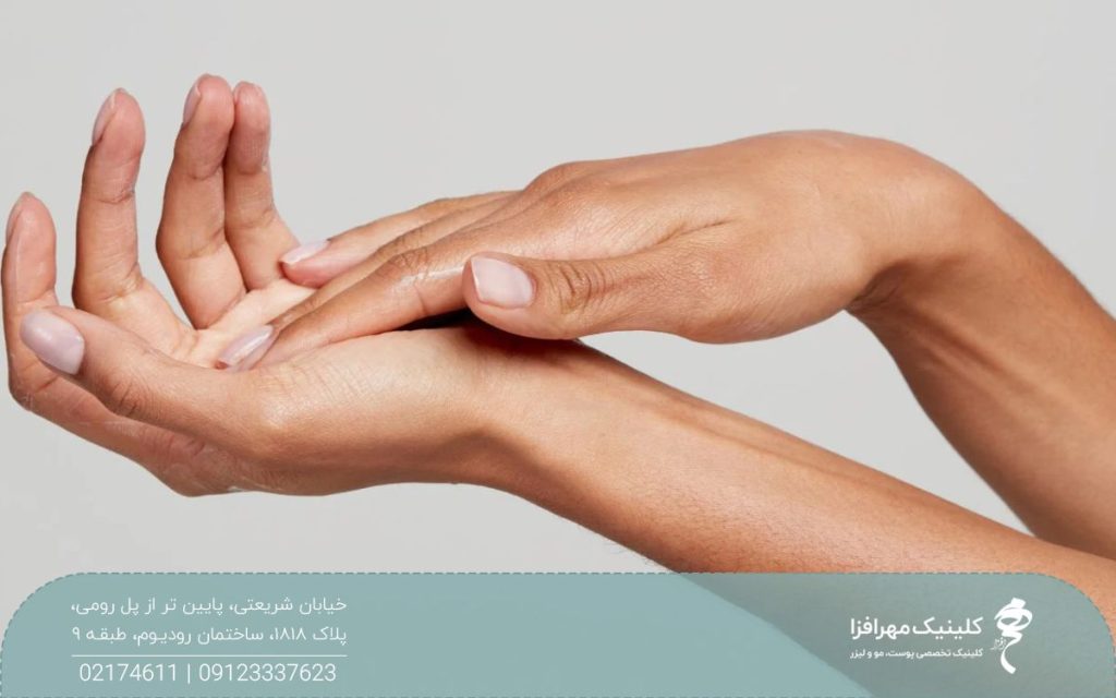 دستان فردی که که کف دست چپ خود را لمس می کند