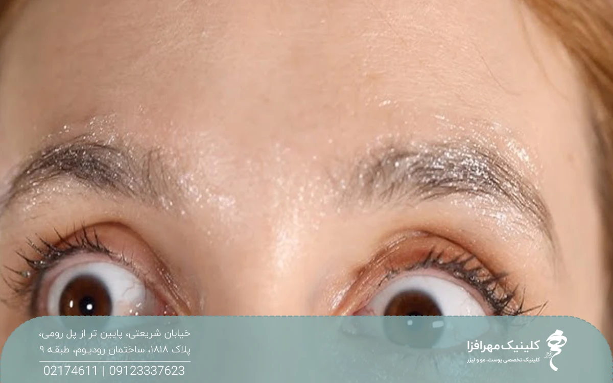 دختری که روی ابروهای وازلین زده است