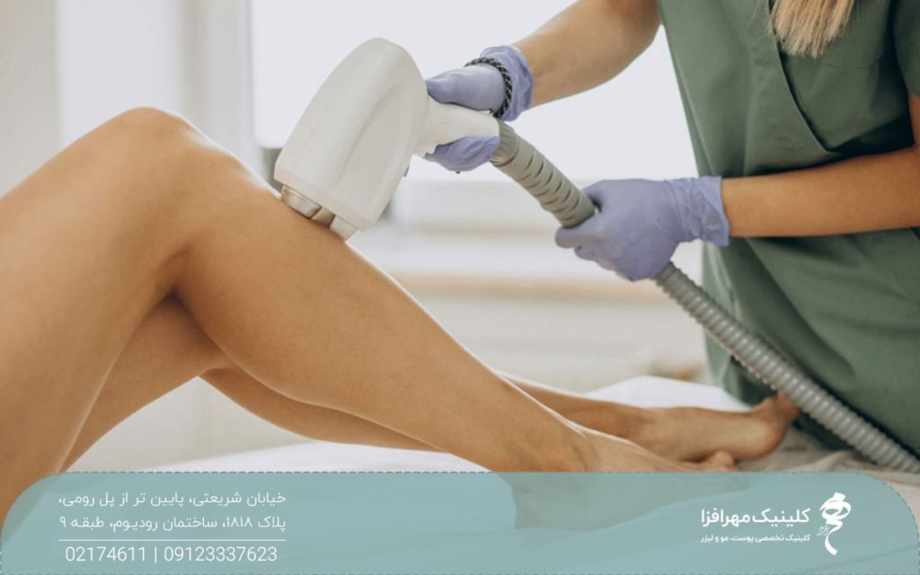 پاهای مراجعه کننده ای که اپراتور لیزر هندپیس دستگاه را روی زیر زانوی او گرفته است