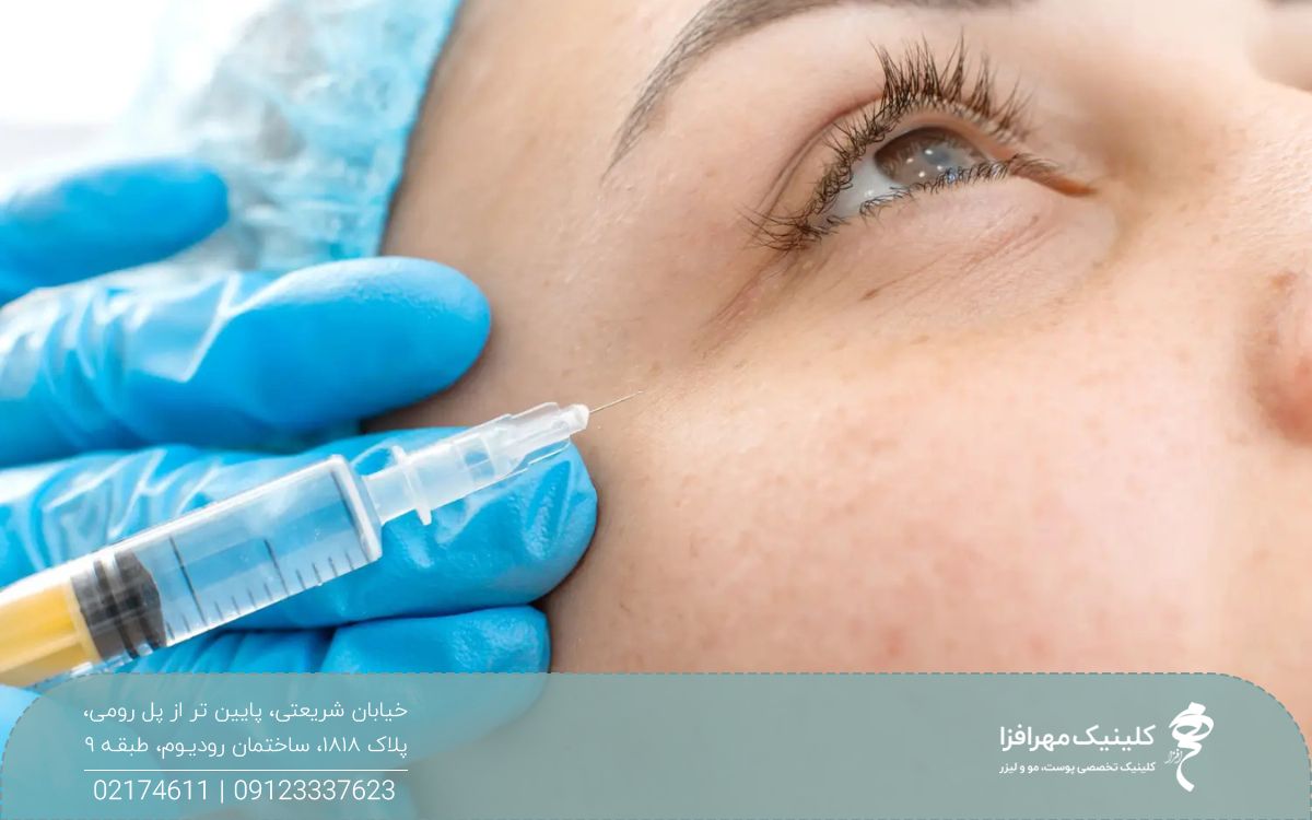دست دکتری که به گوشه چشم زن مزوژل تزریق می کند
