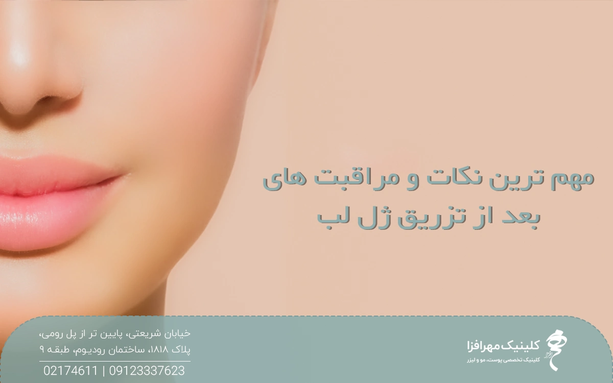 دختری که ژل لب تزریق کرده و چهره او در سمت چپ تصویر قرار دارد و در سمت راست نوشته شده مهم ترین نکات و مراقبت های بعد از تزریق ژل لب