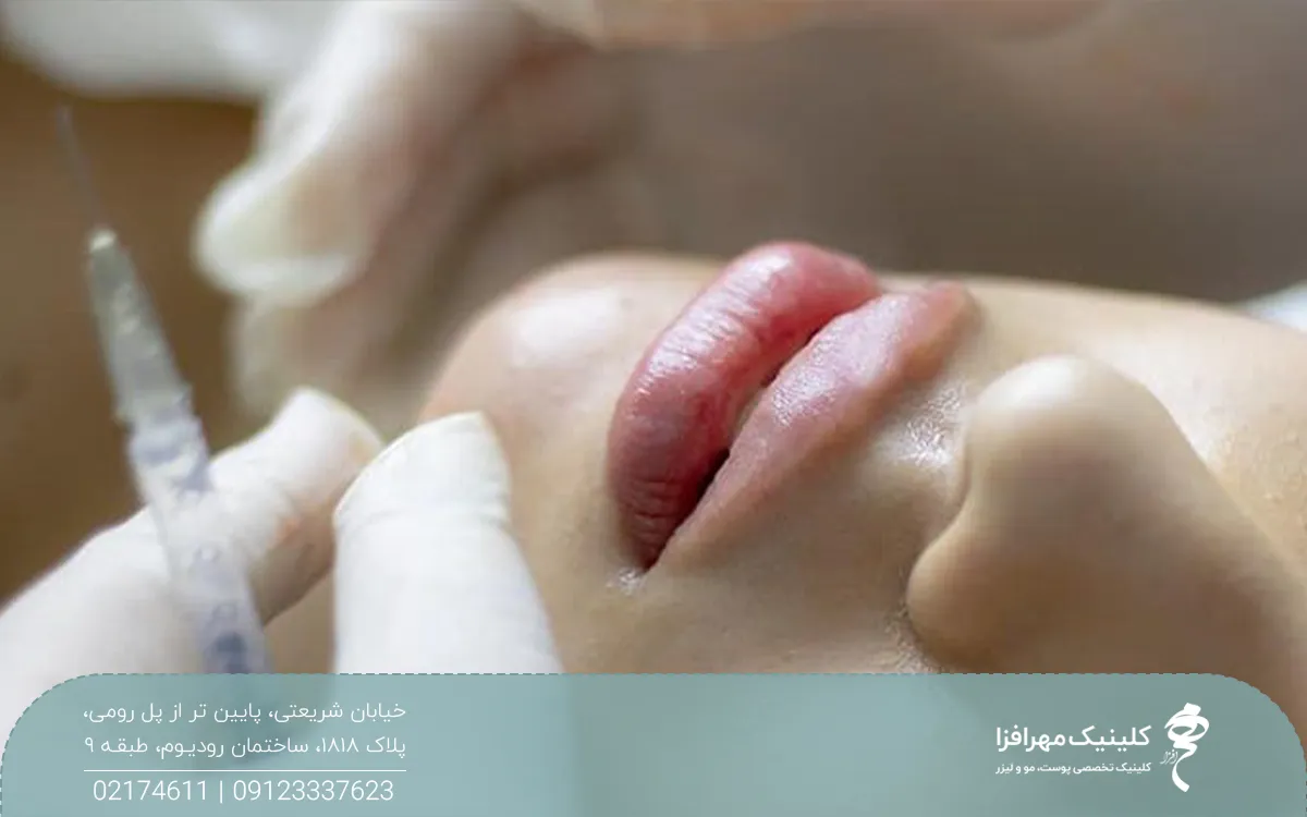 دختری که ژل لب تزریق کرده و پزشک لب پایین او را معاینه می کند